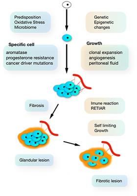 Pathogenesis Based Diagnosis and Treatment of Endometriosis